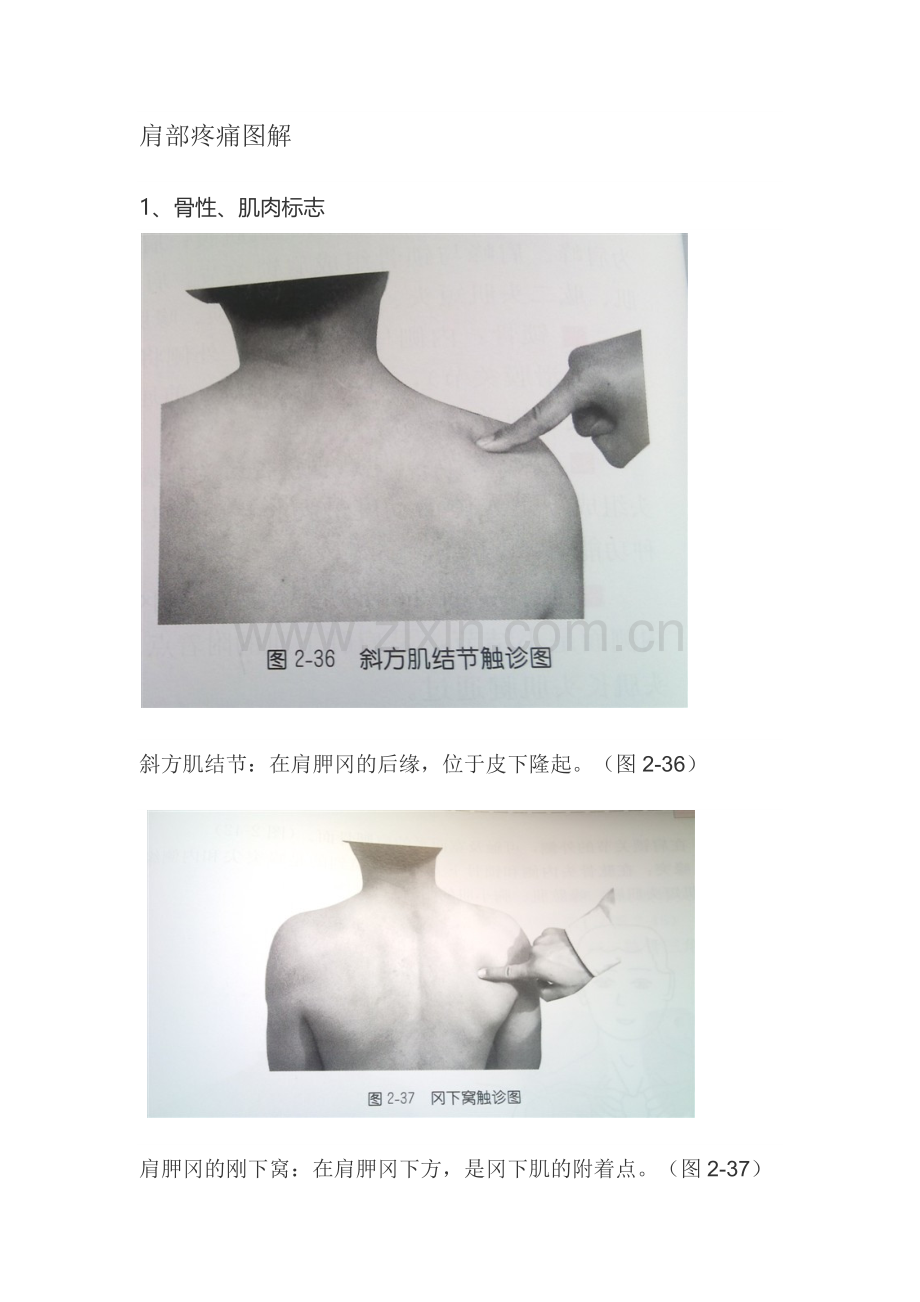 肩部疼痛图解.docx_第1页