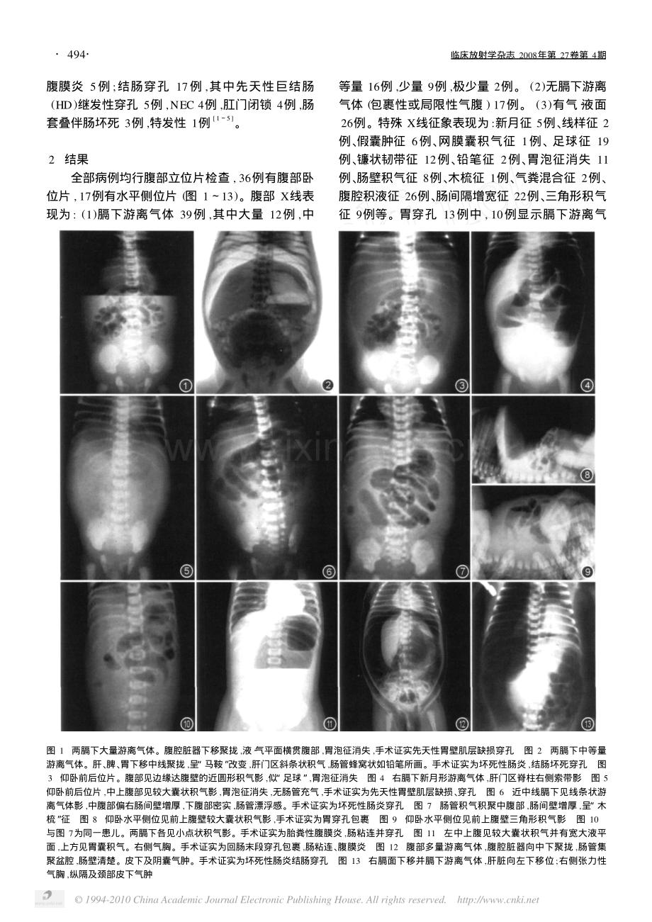 新生儿胃肠道穿孔的特殊X线征象及价值[1].pdf_第2页