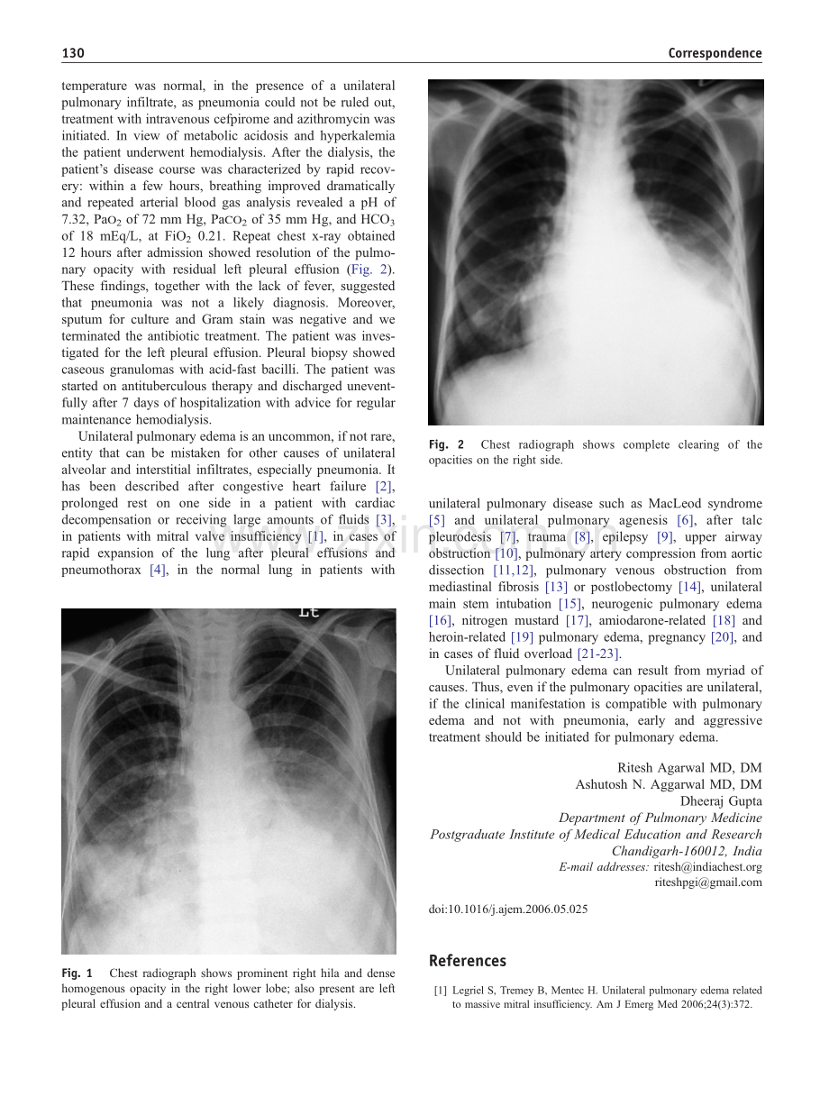 单侧肺水肿的原因.pdf_第2页