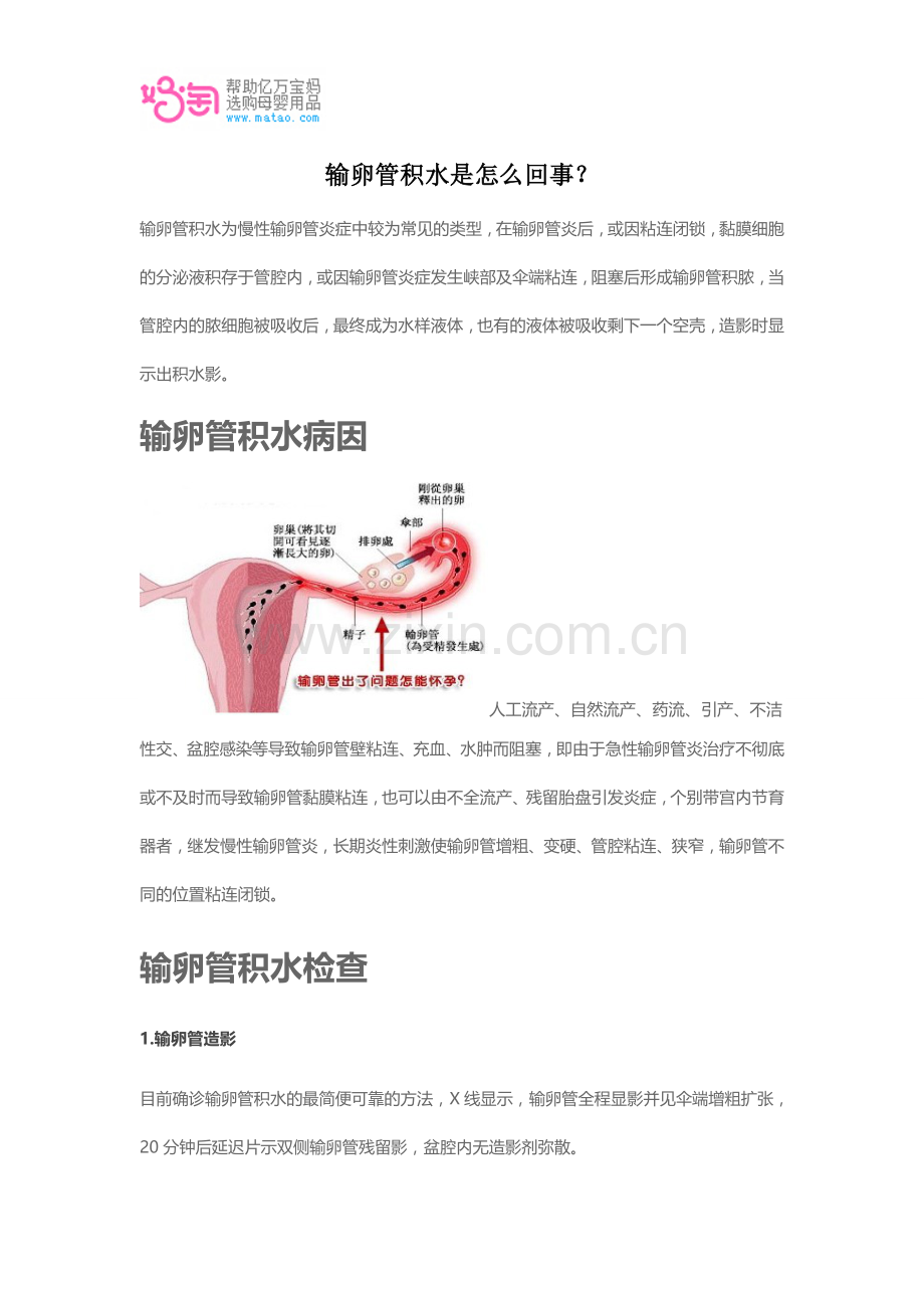 输卵管积水是怎么回事？.doc_第1页
