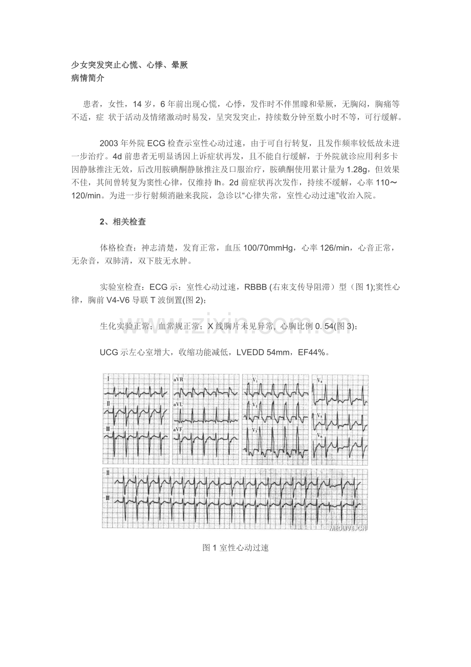 少女突发突止心慌.doc_第1页