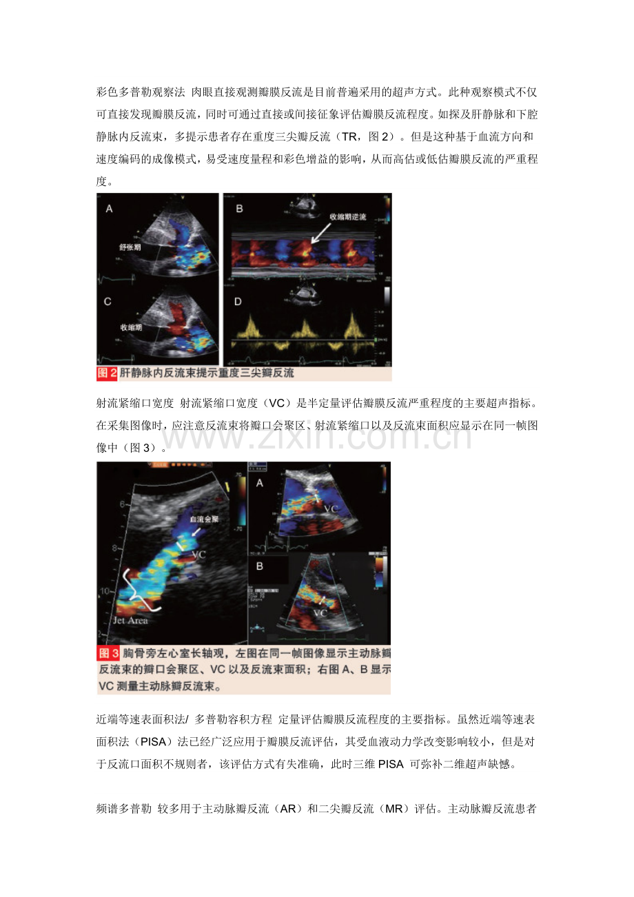 超声心动图.doc_第2页