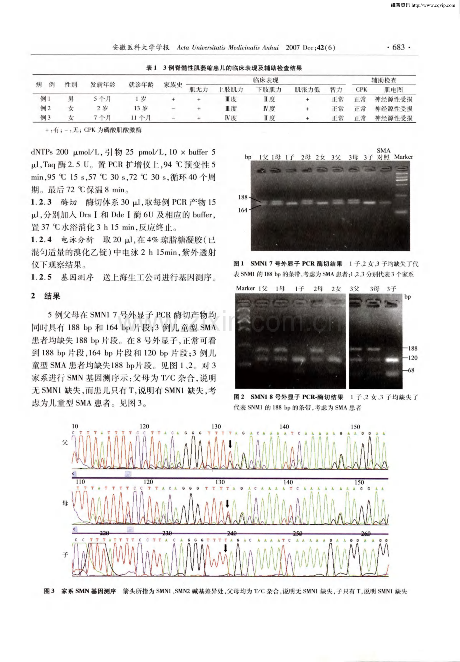 SMN基因诊断小儿脊髓性肌萎缩症.pdf_第2页
