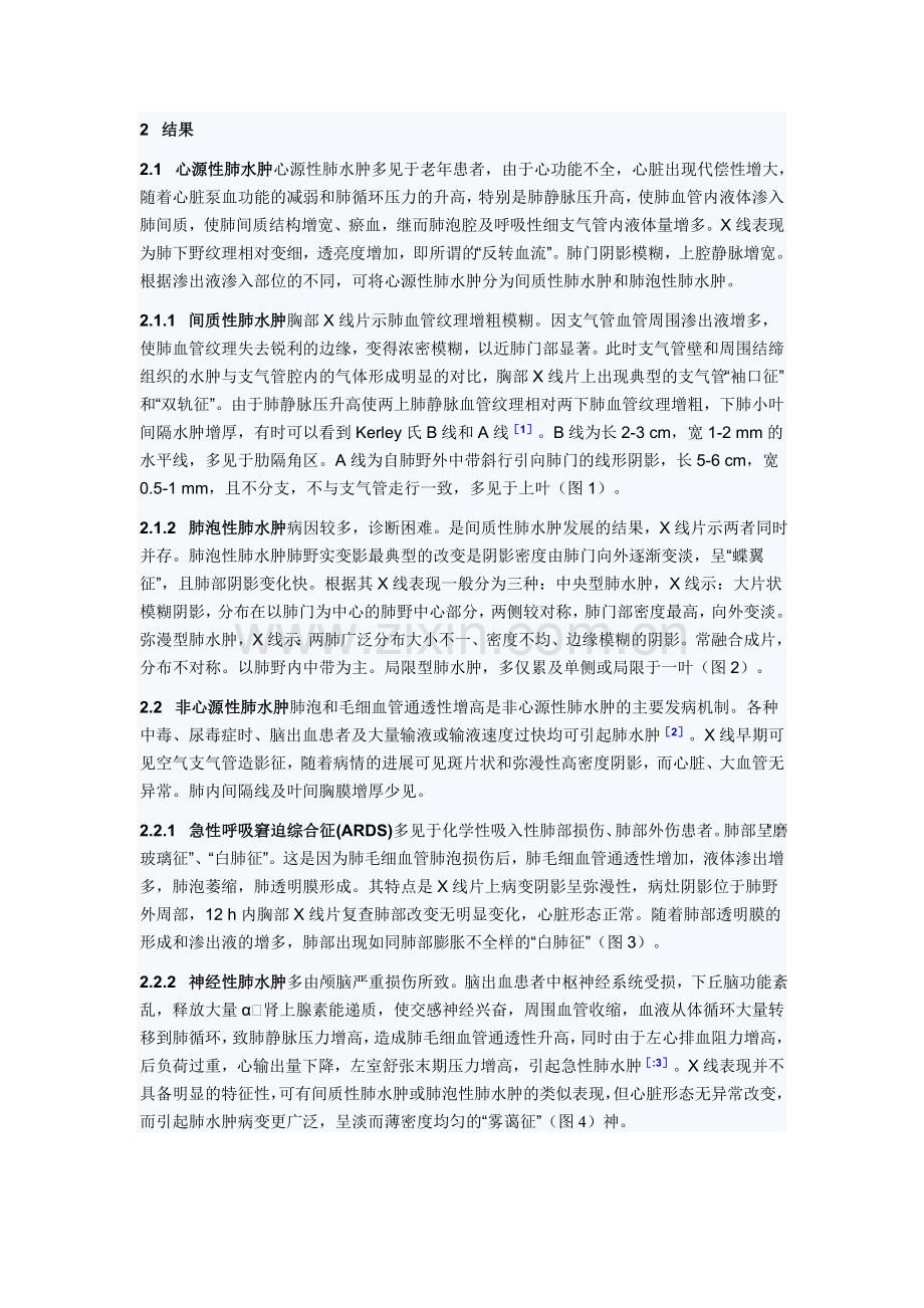 肺水肿X线征象分析1.doc_第2页