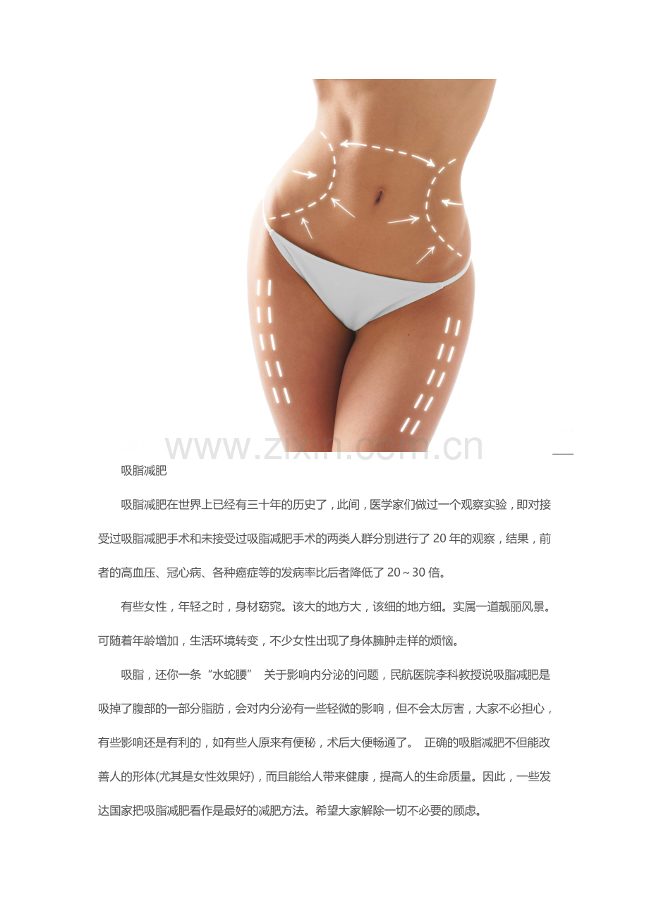 时下最走俏整形手术大搜集.doc_第2页