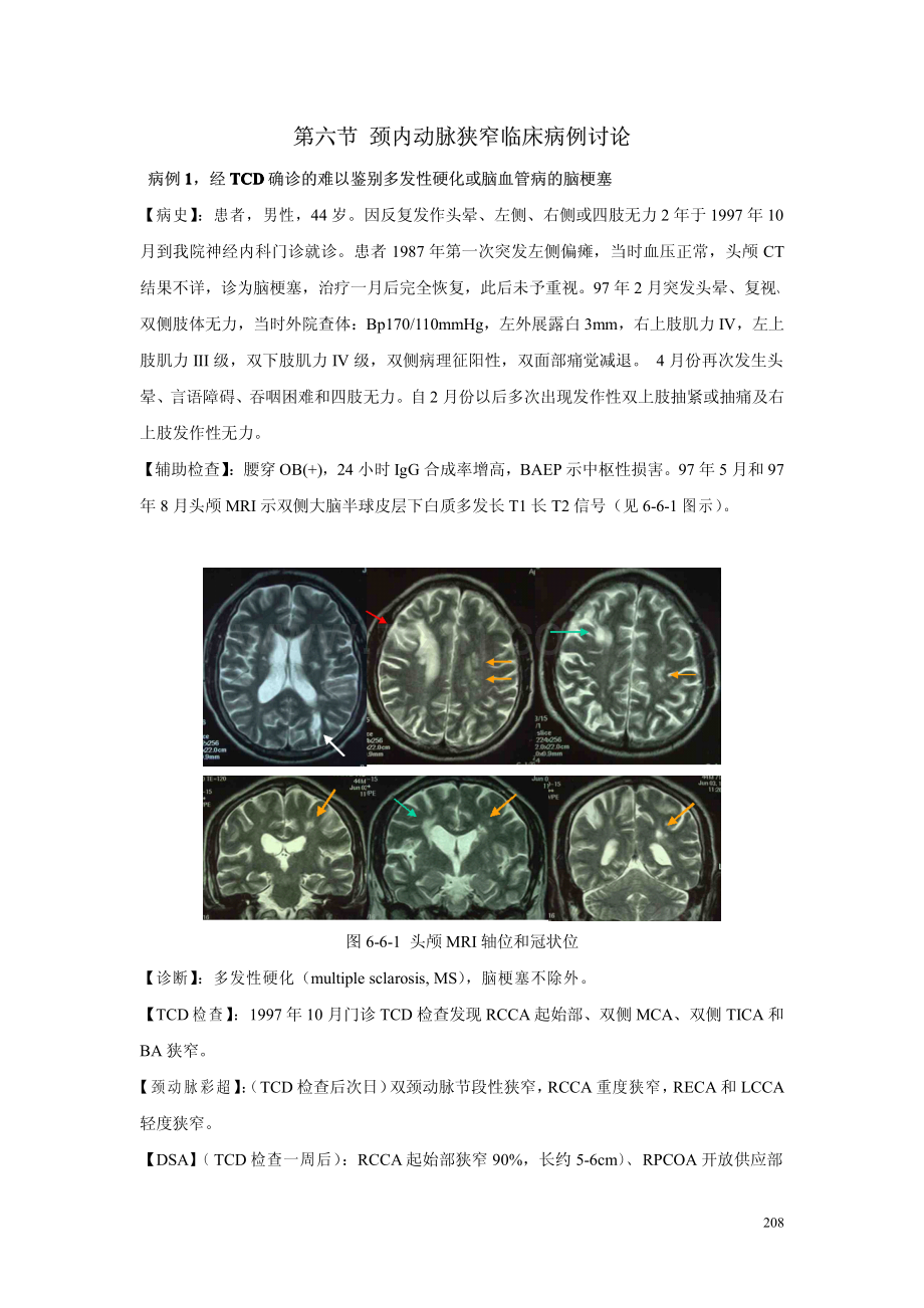 第六章 第六节颈内动脉狭窄临床病例讨论1.pdf_第1页