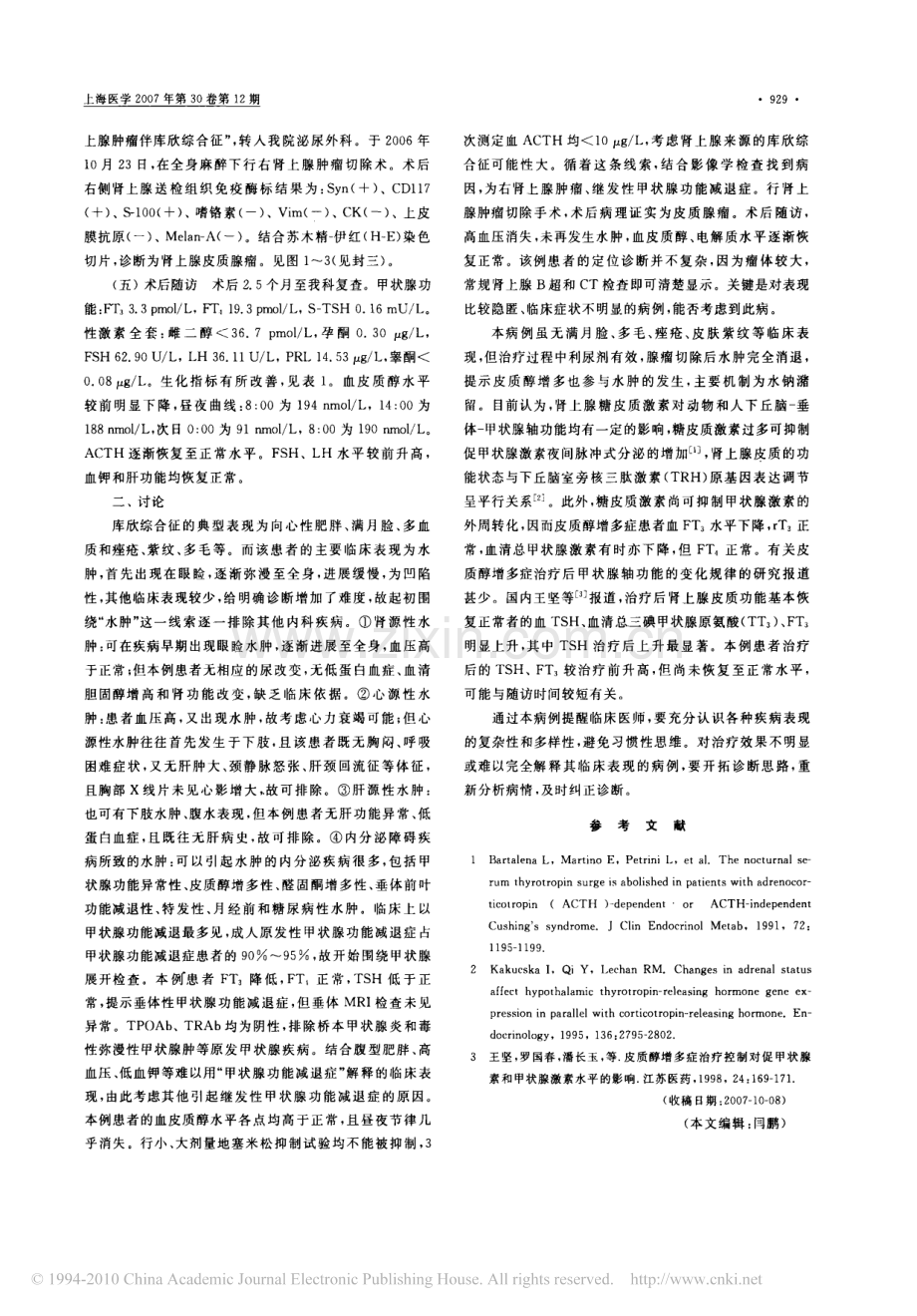 以水肿为首发表现的库欣综合征一例.pdf_第2页
