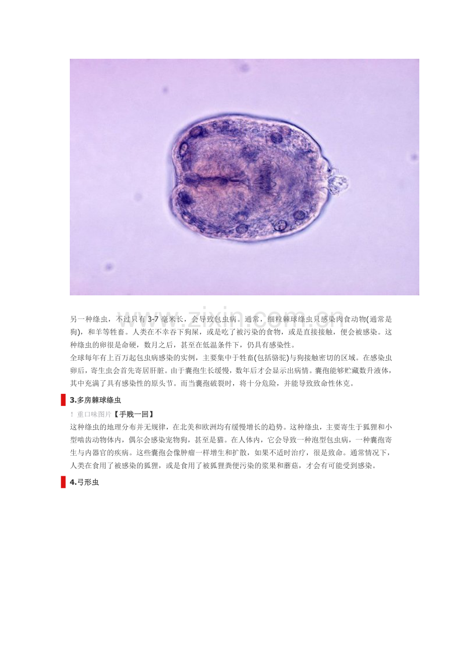 食物中可能带有的10种寄生虫.doc_第2页