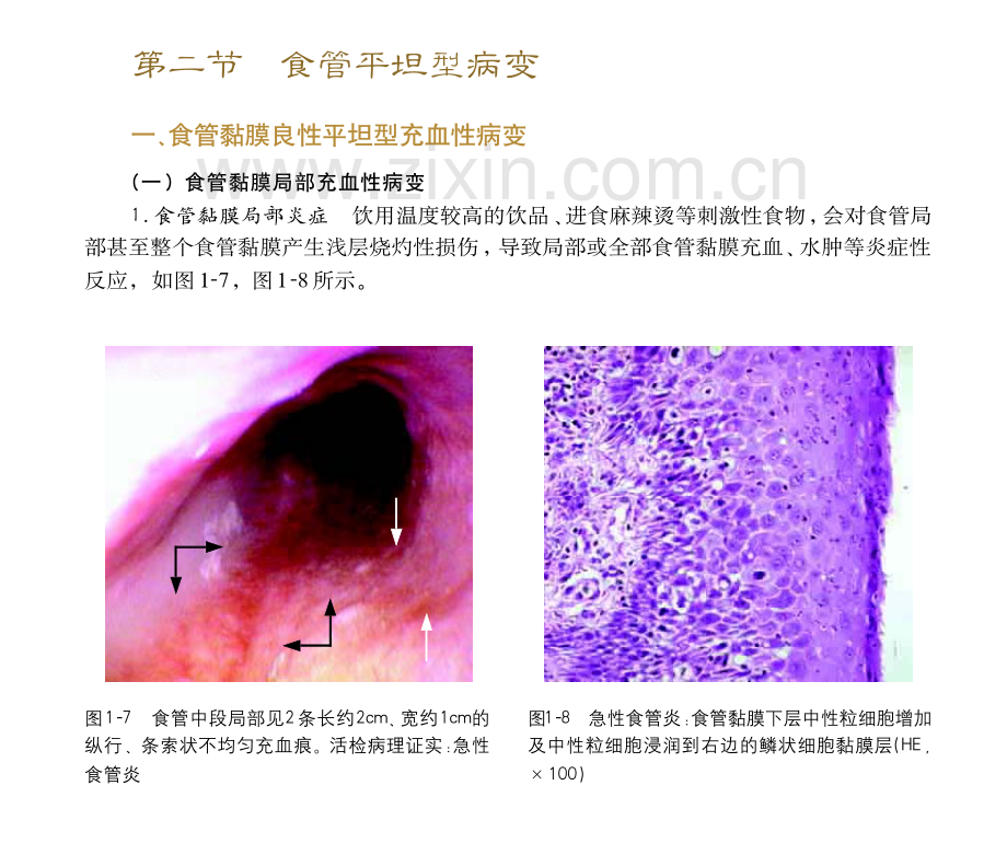 胃镜操作小册子.pdf_第1页