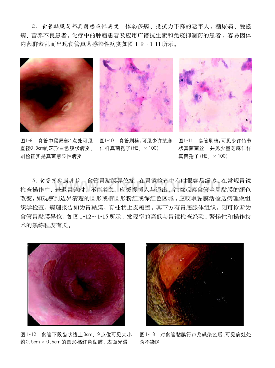 胃镜操作小册子.pdf_第2页