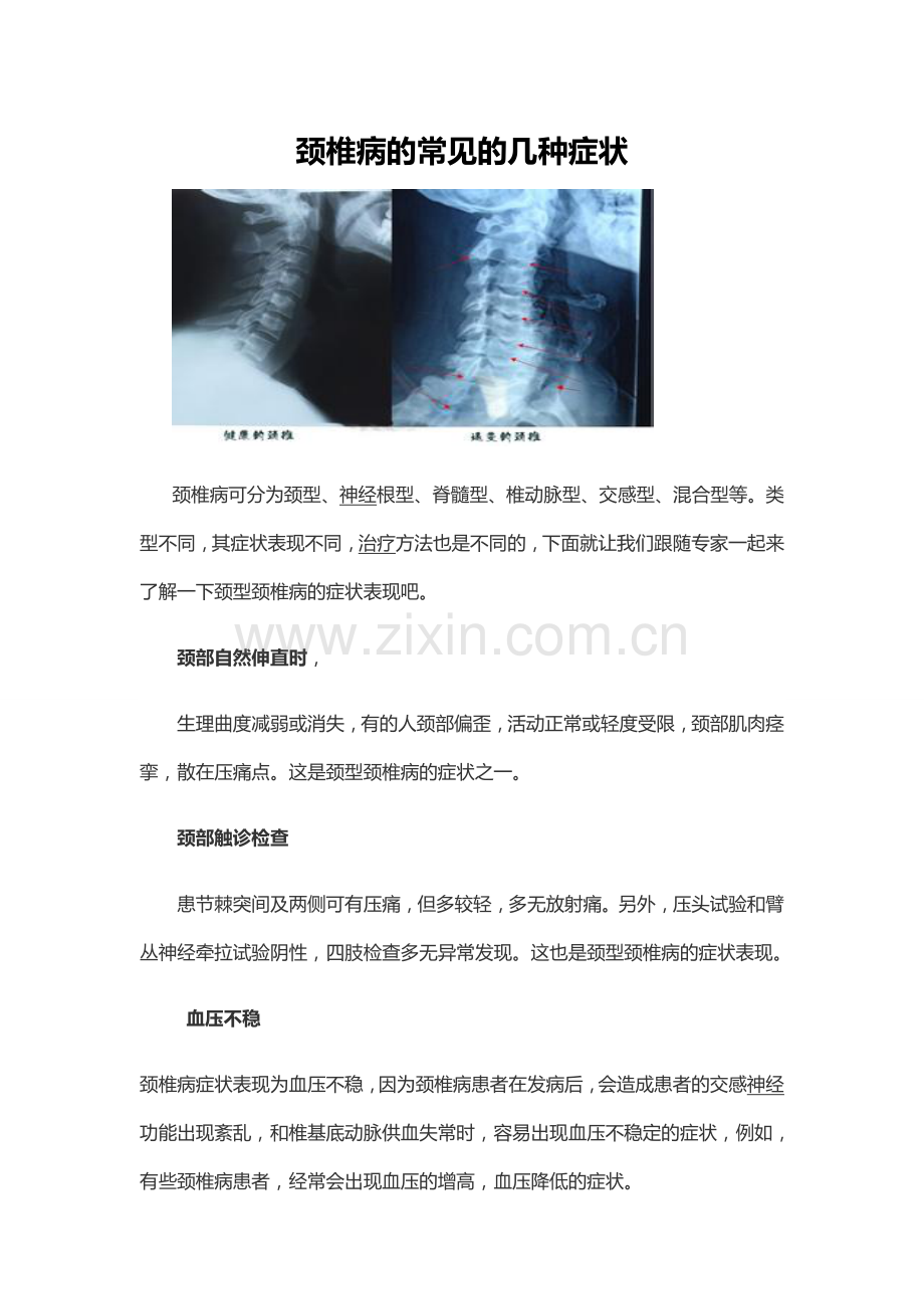 颈椎病是什么症状.doc_第1页