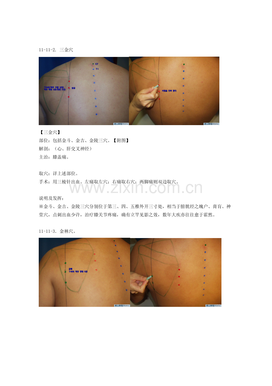 董氏奇穴发挥11.pdf_第2页