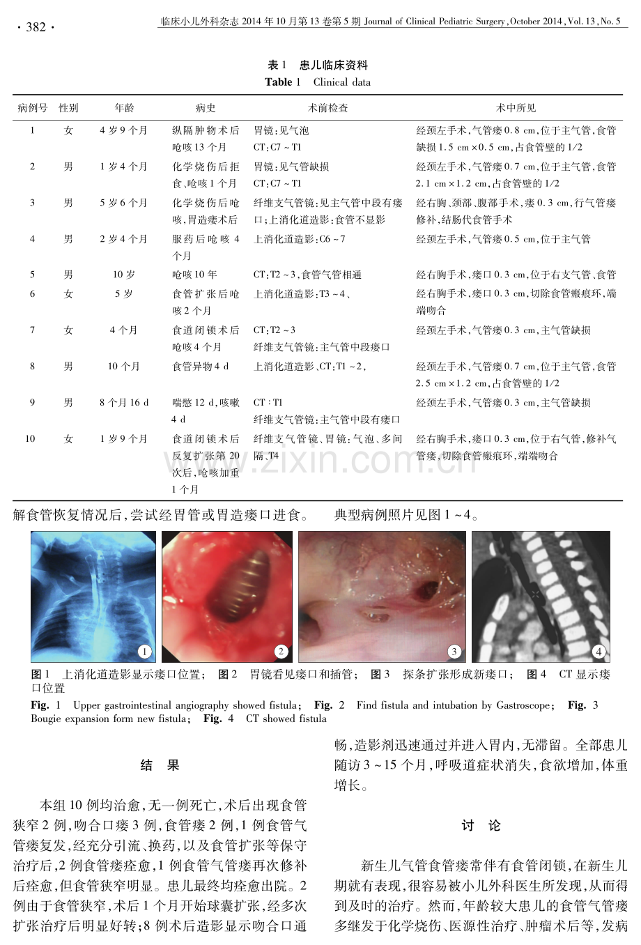 小儿气管食管瘘手术治疗分析.pdf_第2页