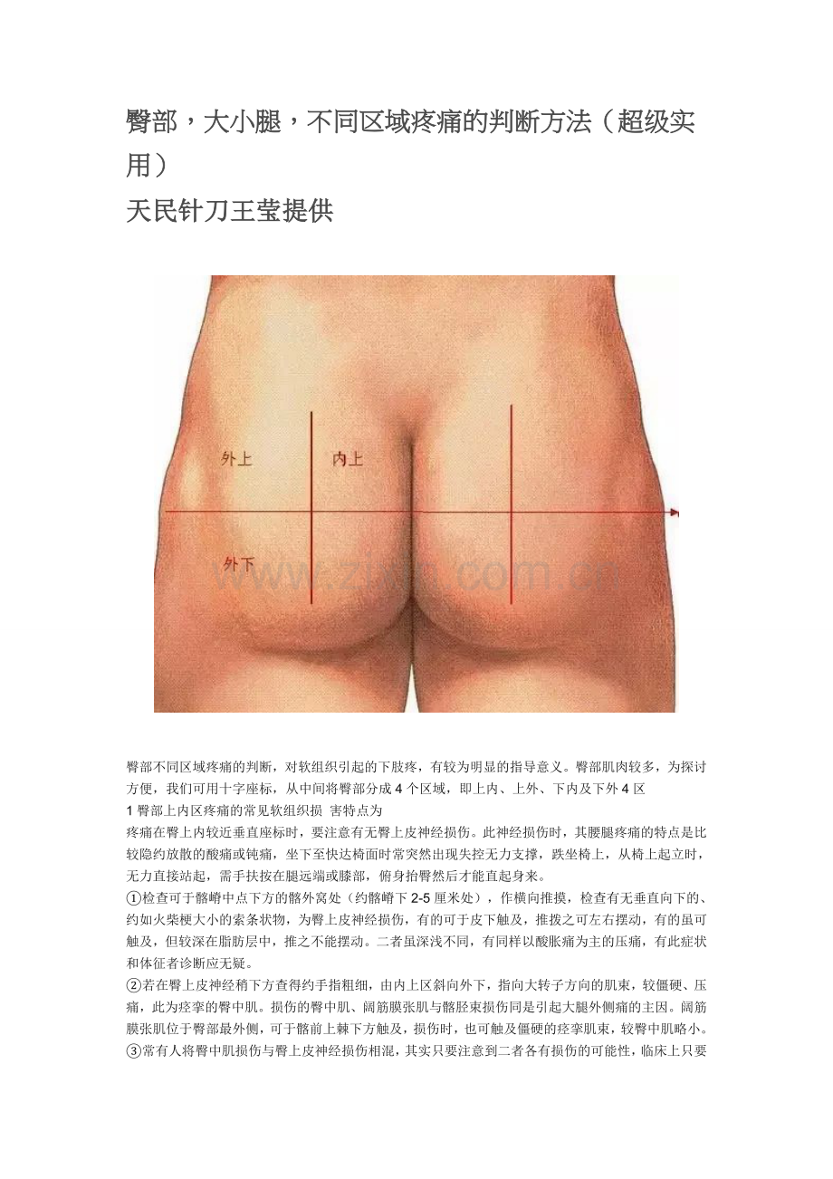 臀部,大小腿,不同区域疼痛的判断方法.doc_第1页