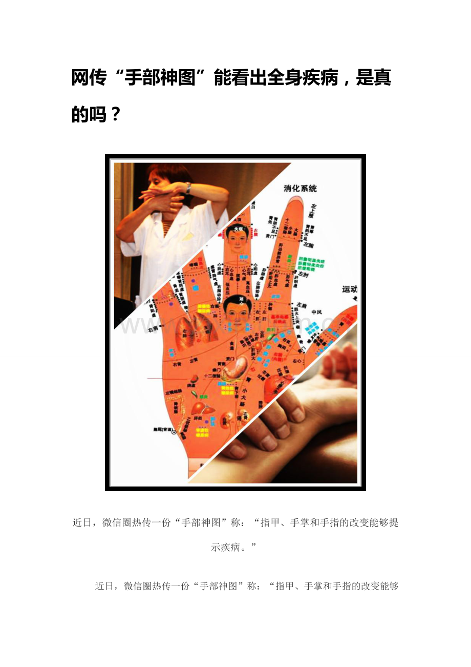网传“手部神图”能看出全身疾病,是真的吗？.doc_第1页