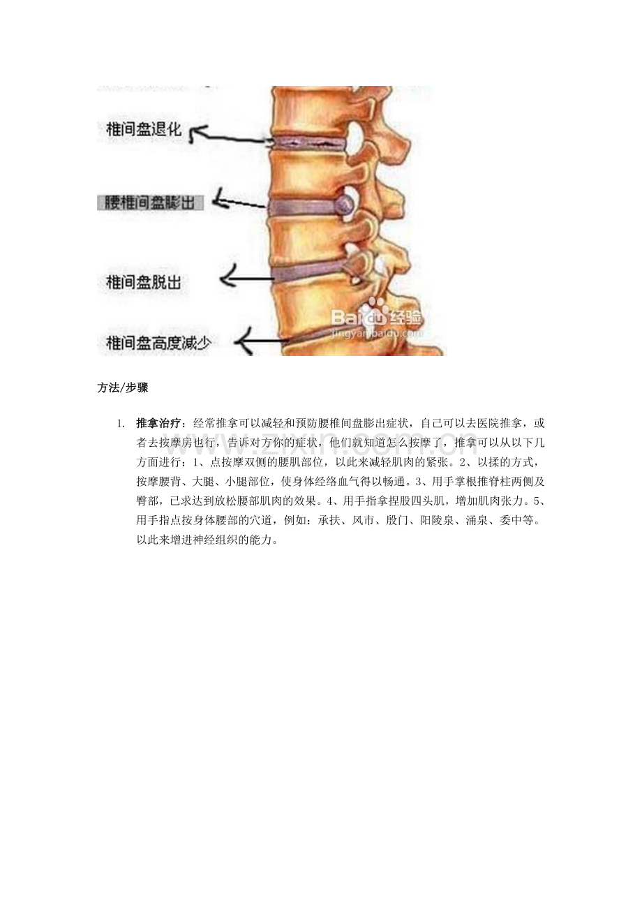 腰病的防治方法.doc_第2页