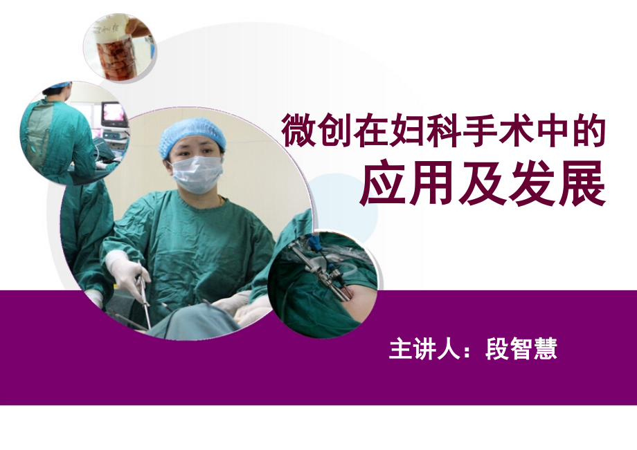 微创在妇科手术中的应用及发展.ppt_第2页