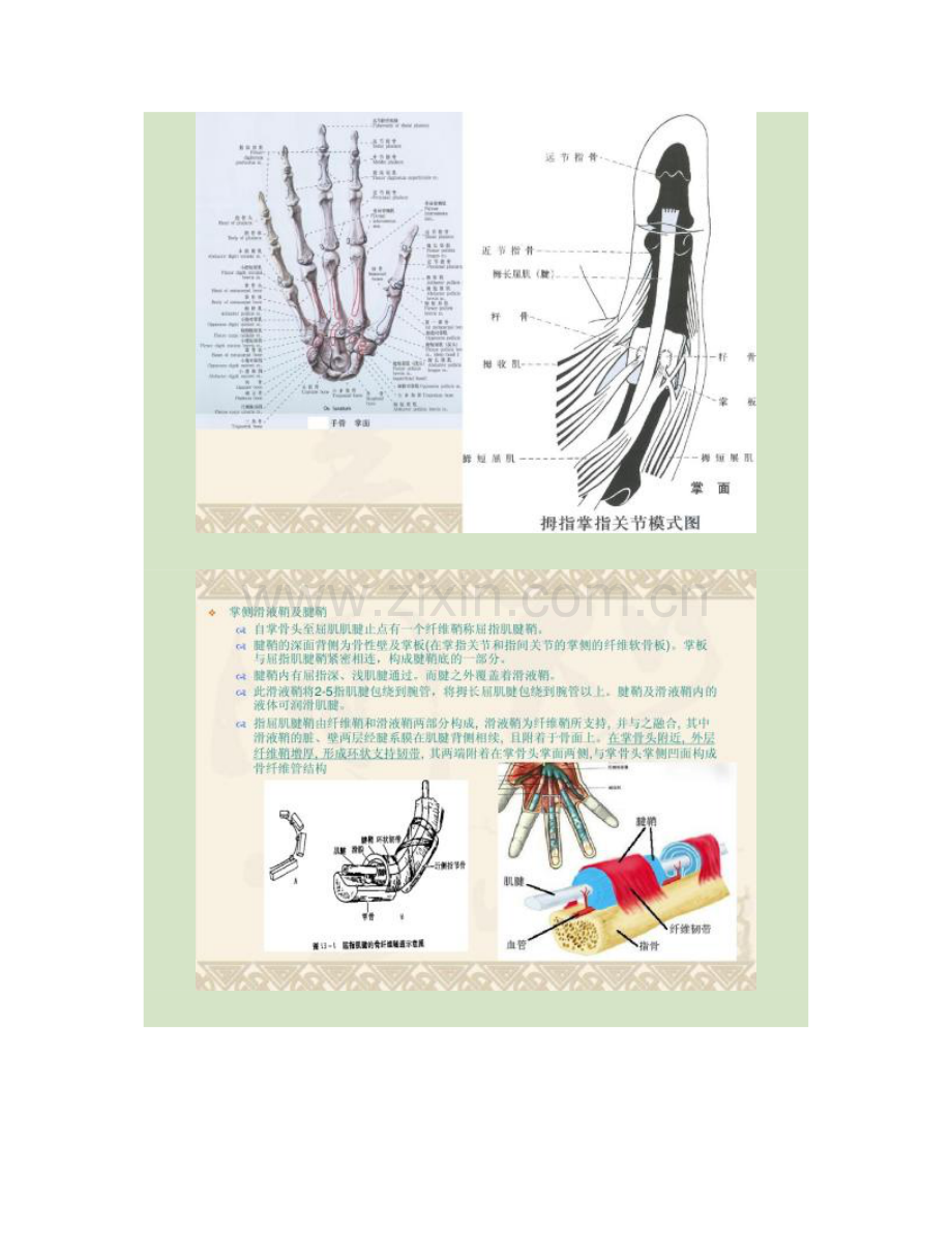 屈指肌狭窄性腱鞘炎解读.doc_第2页