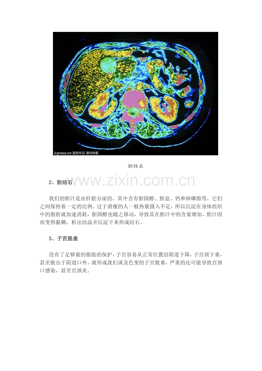 女人太苗条易得10种病.doc_第2页