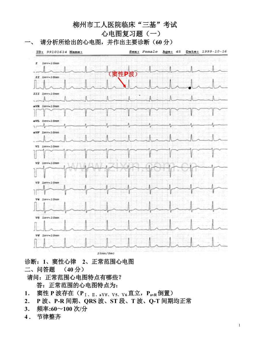 临床“三基”考试心电图复习题(图及答案)-(1).doc_第1页