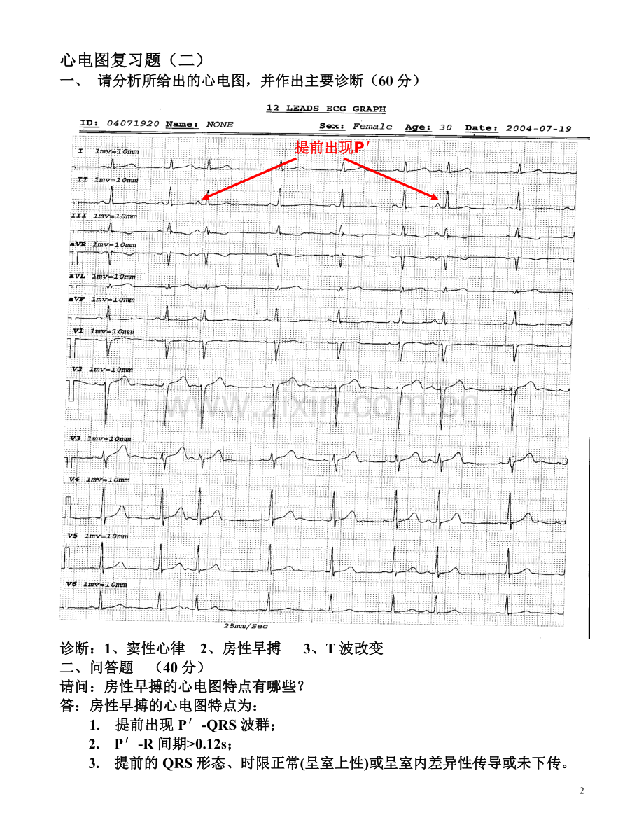 临床“三基”考试心电图复习题(图及答案)-(1).doc_第2页
