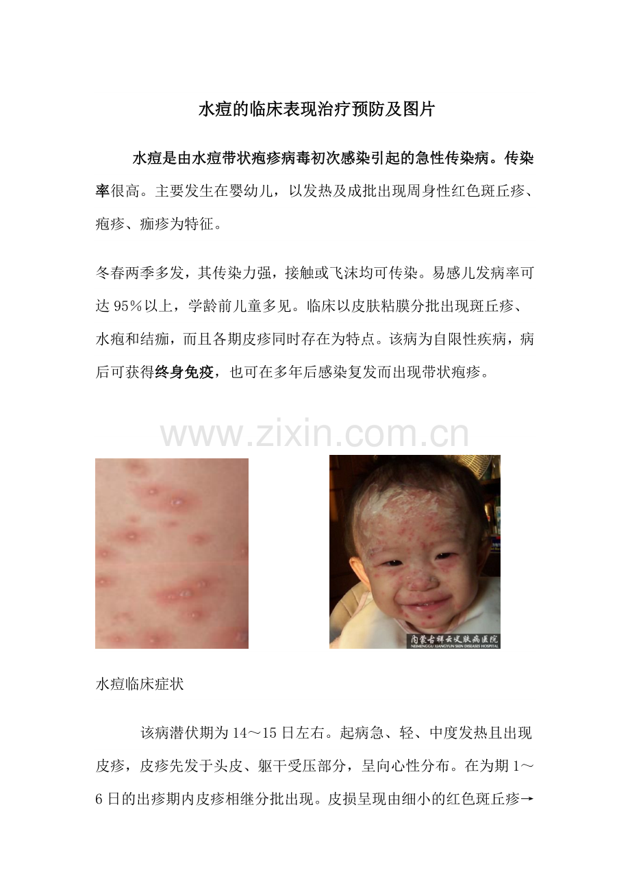 水痘的临床表现及预防附有图片.doc_第1页