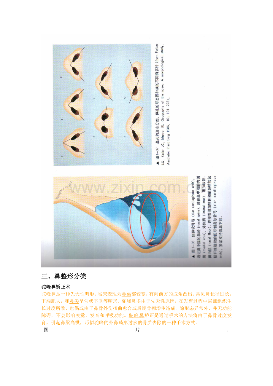 太平洋鼻部整形文字材料.doc_第2页