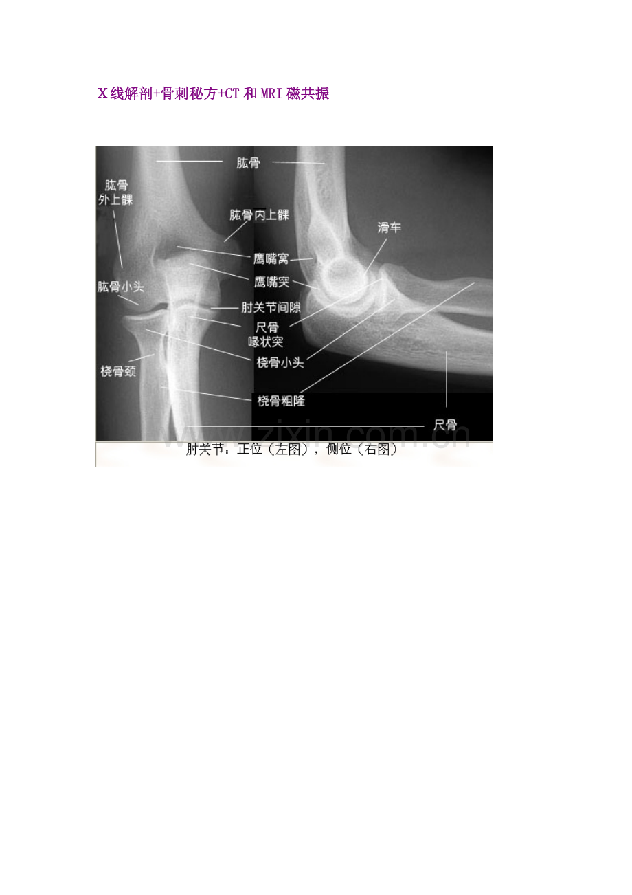 X CT MRI.docx_第1页