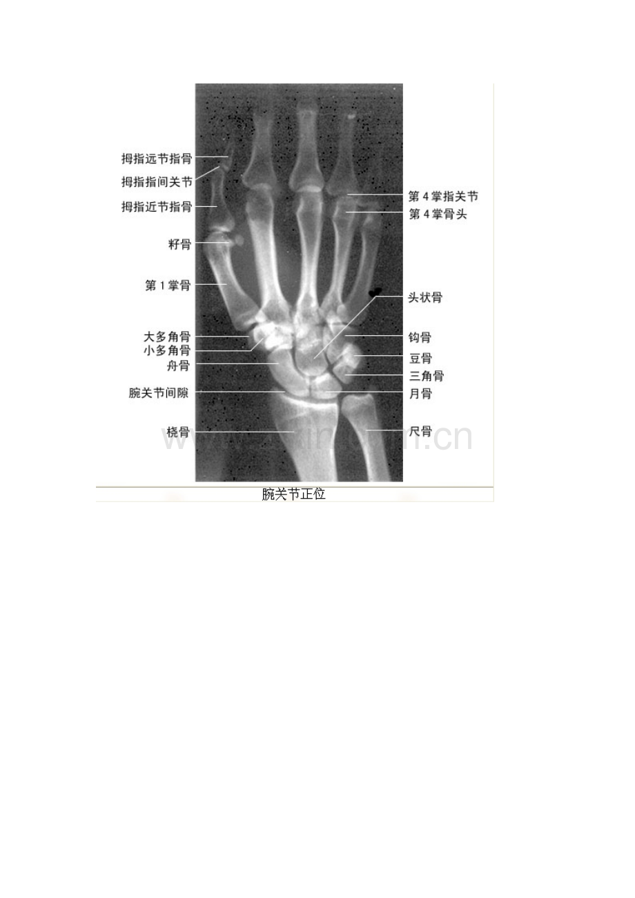 X CT MRI.docx_第2页