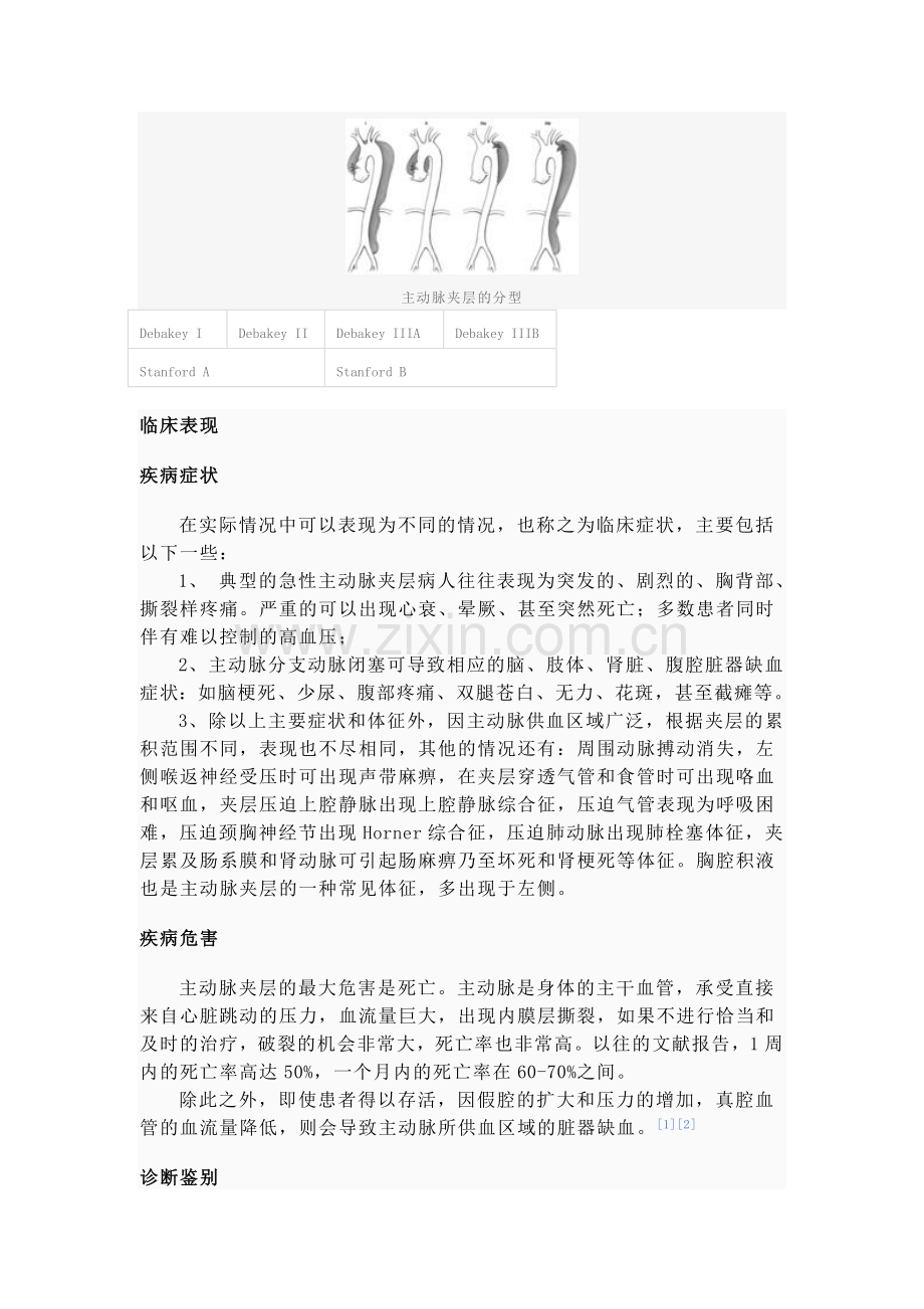 主动脉夹层2.doc_第2页