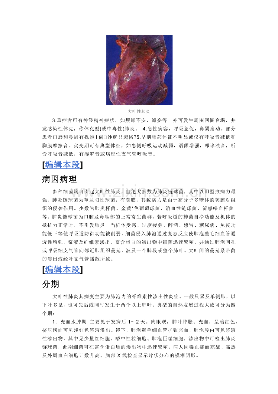 大叶性肺炎.doc_第2页