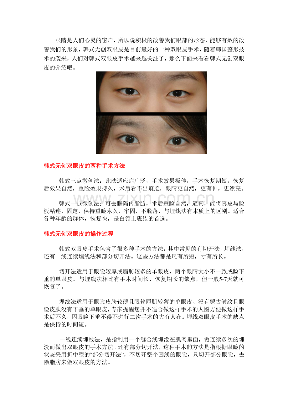 韩式无创双眼皮简介.doc_第1页