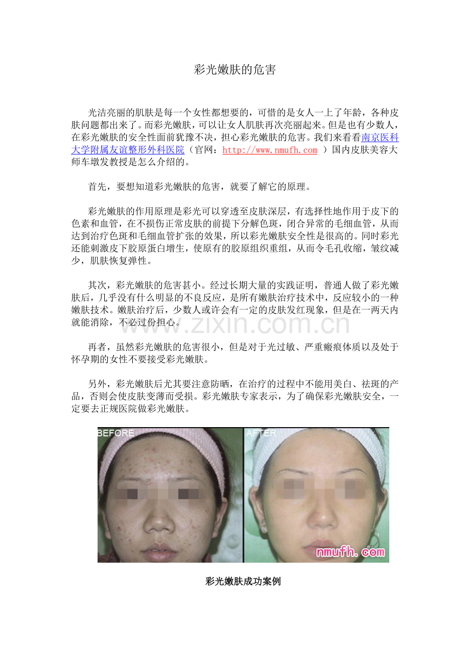 彩光嫩肤的危害.doc_第1页