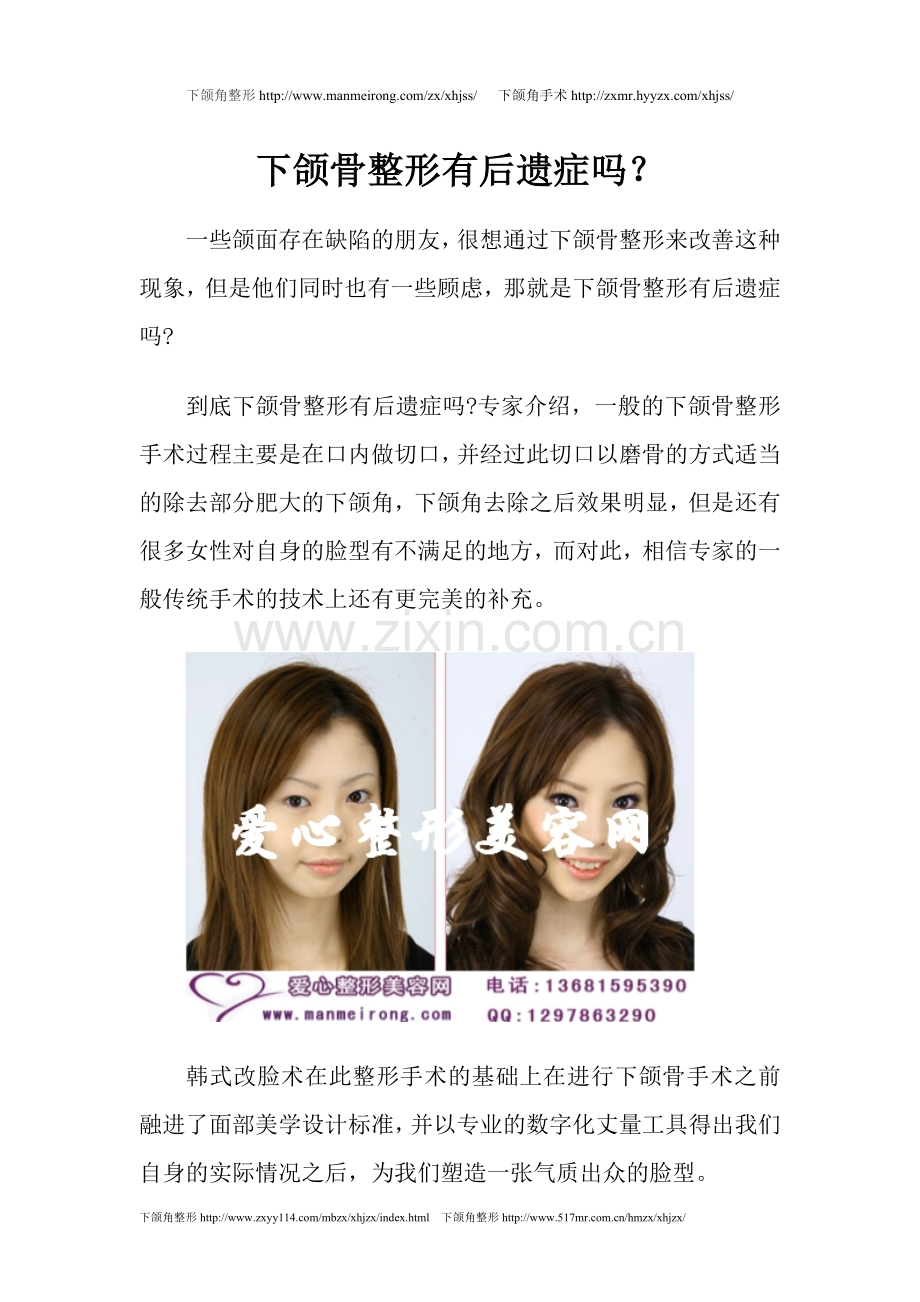 下颌骨整形有后遗症吗.doc_第1页
