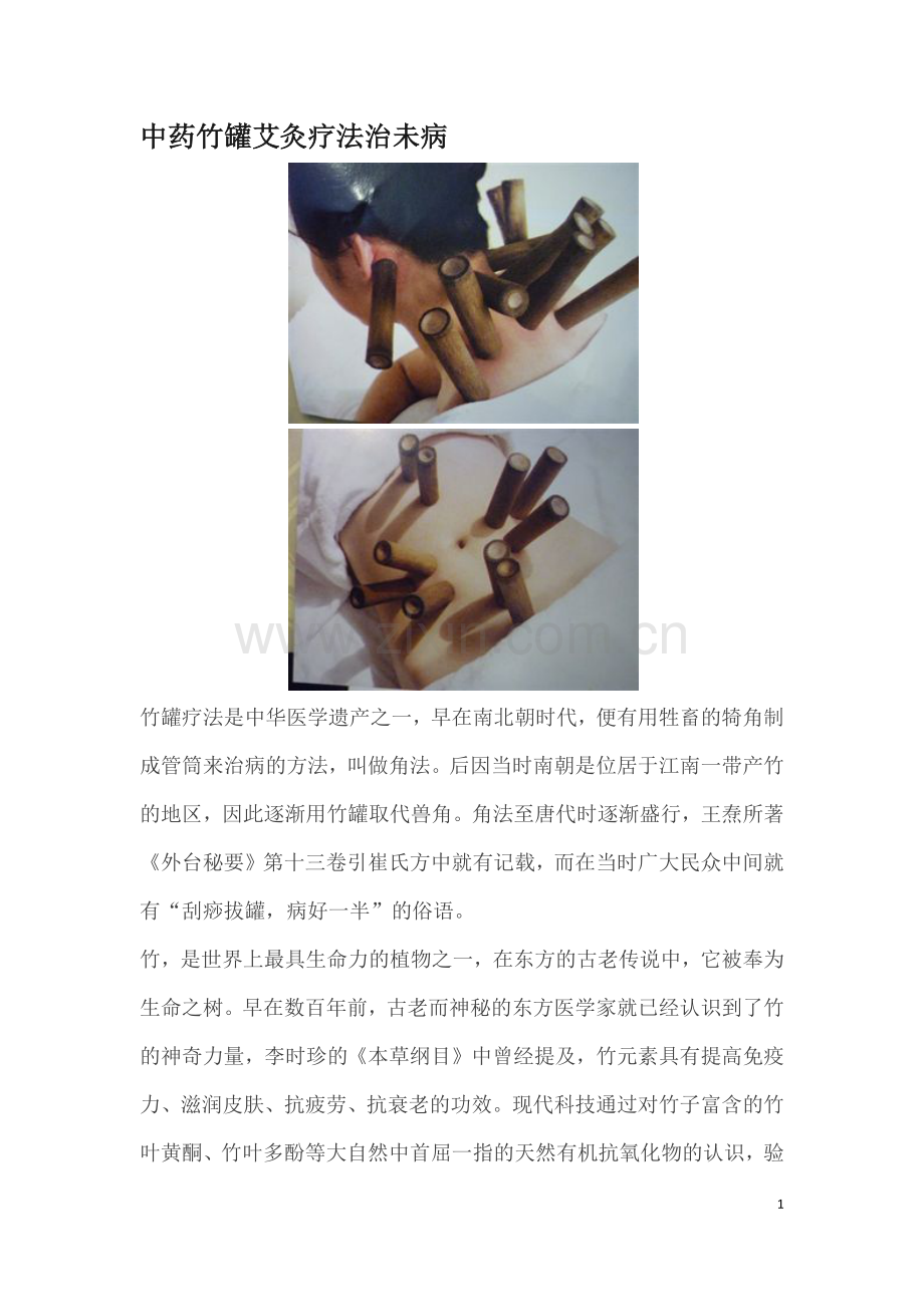中药竹罐艾灸疗法治未病.docx_第1页