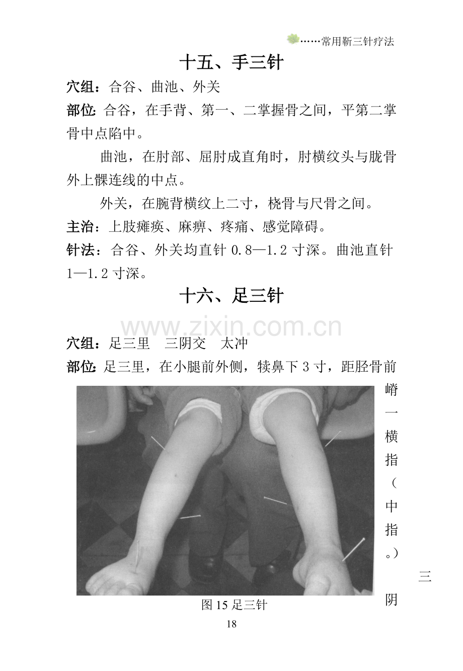靳三针疗法15-23.doc_第1页