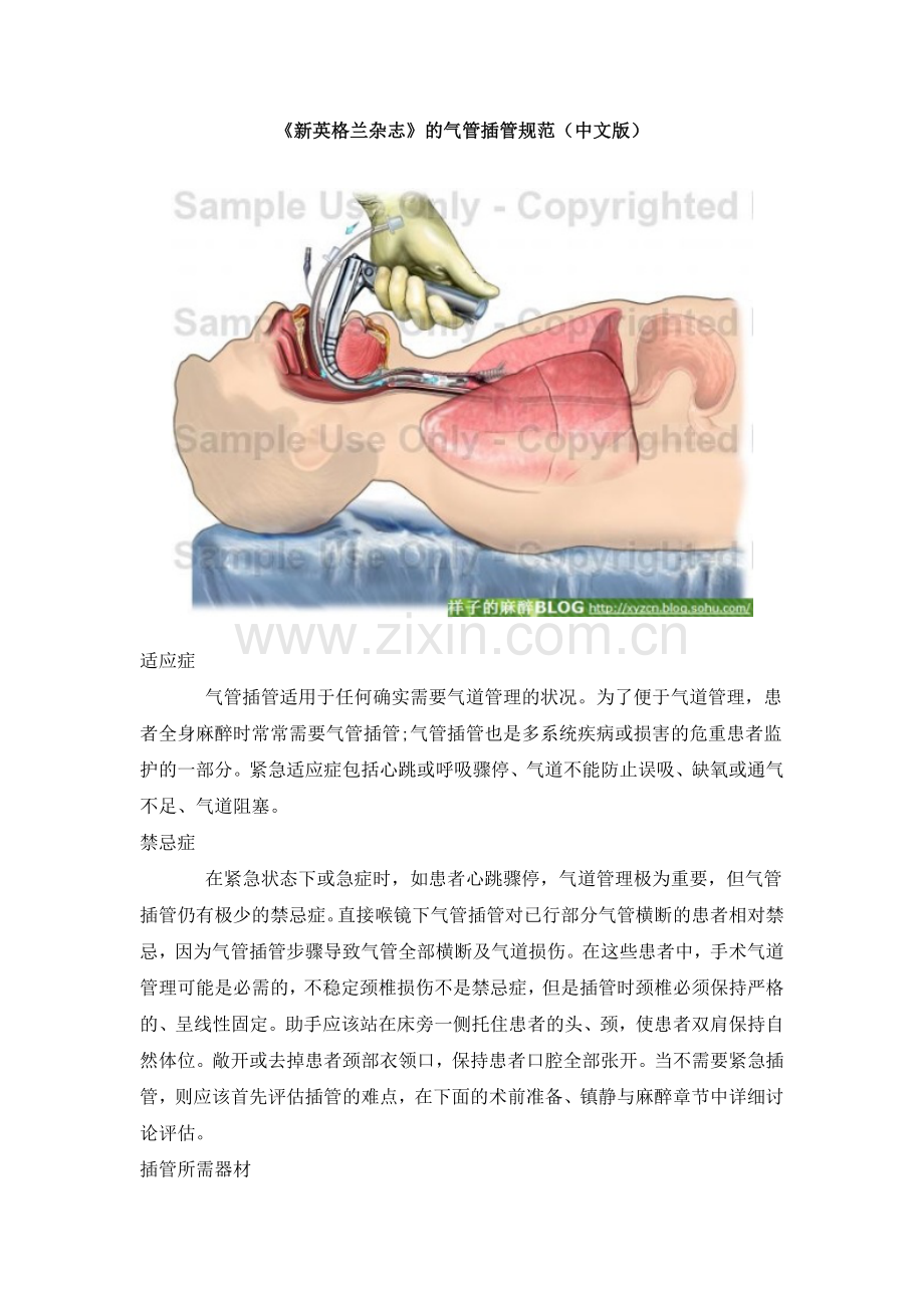 新英格兰杂志的气管插管规范中文版.doc_第1页