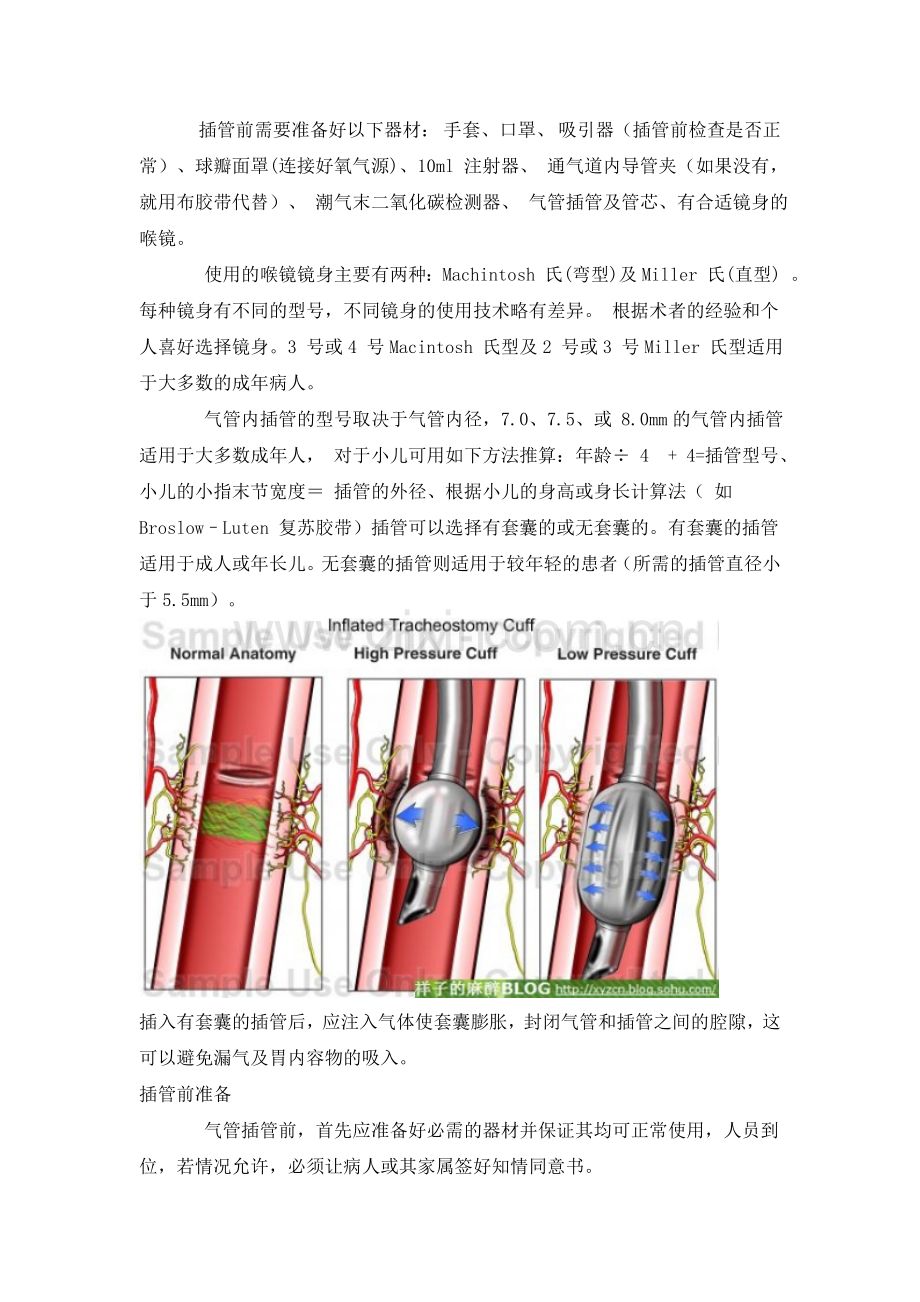 新英格兰杂志的气管插管规范中文版.doc_第2页