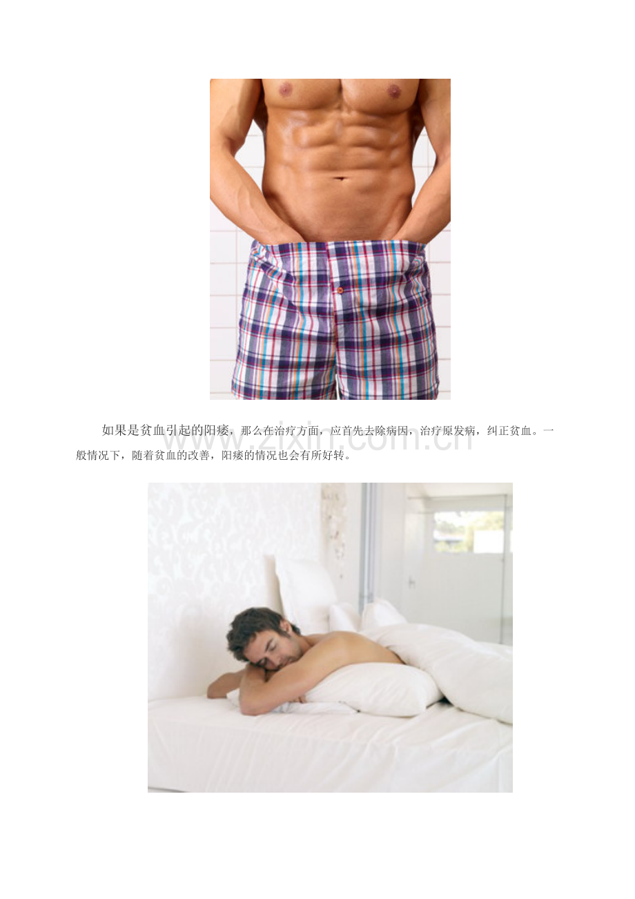 男性养生：5种反常表现说明你贫血了.doc_第2页