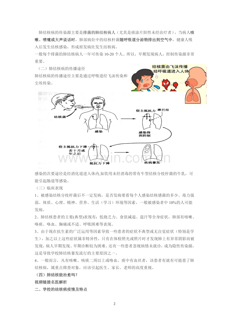 预防肺结核班会教案.doc_第2页