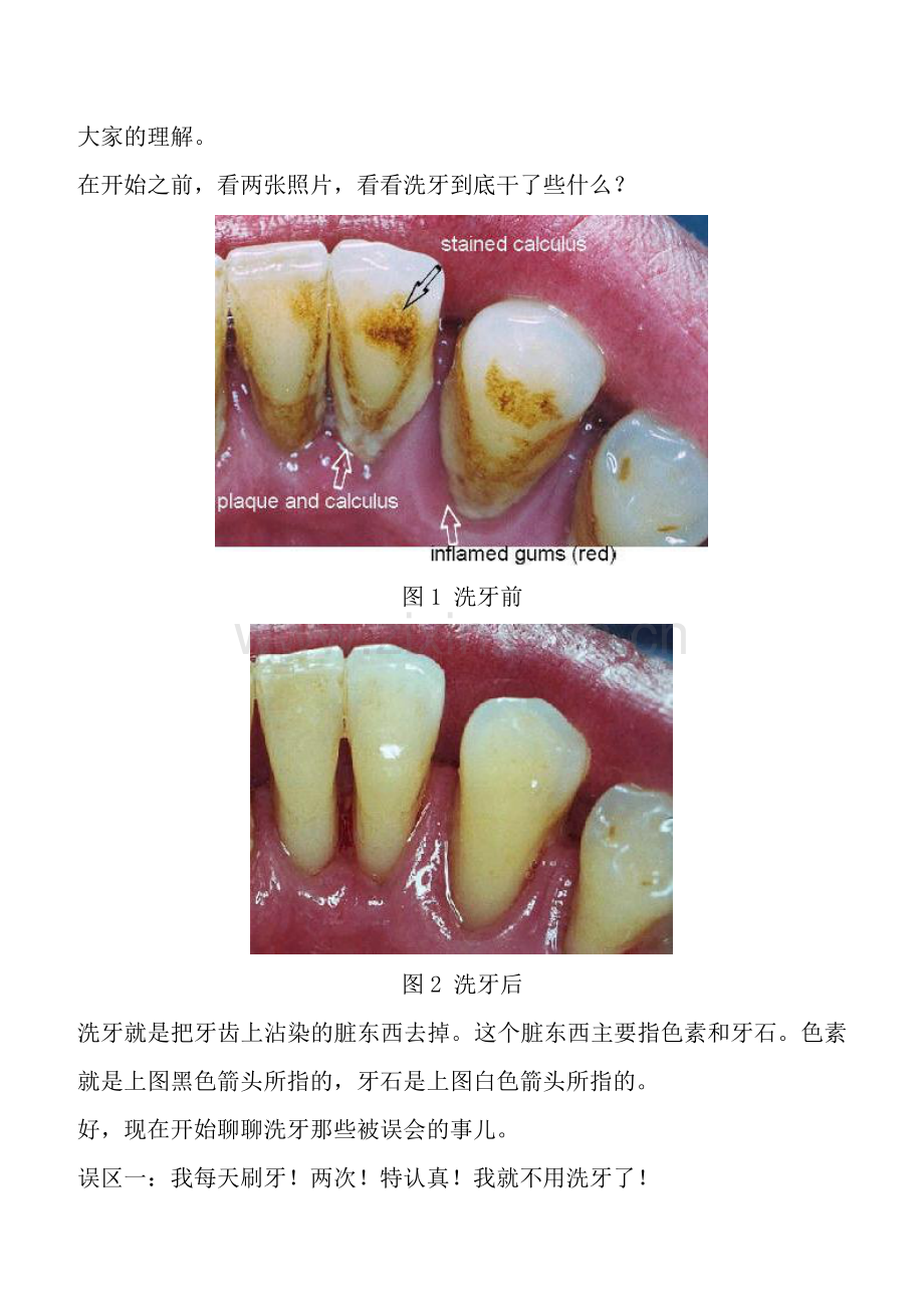 来给洗牙辟个.docx_第2页