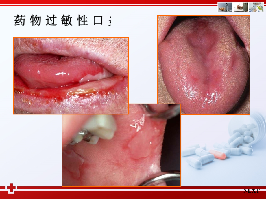 变态反应性疾病的药物治疗.ppt_第2页