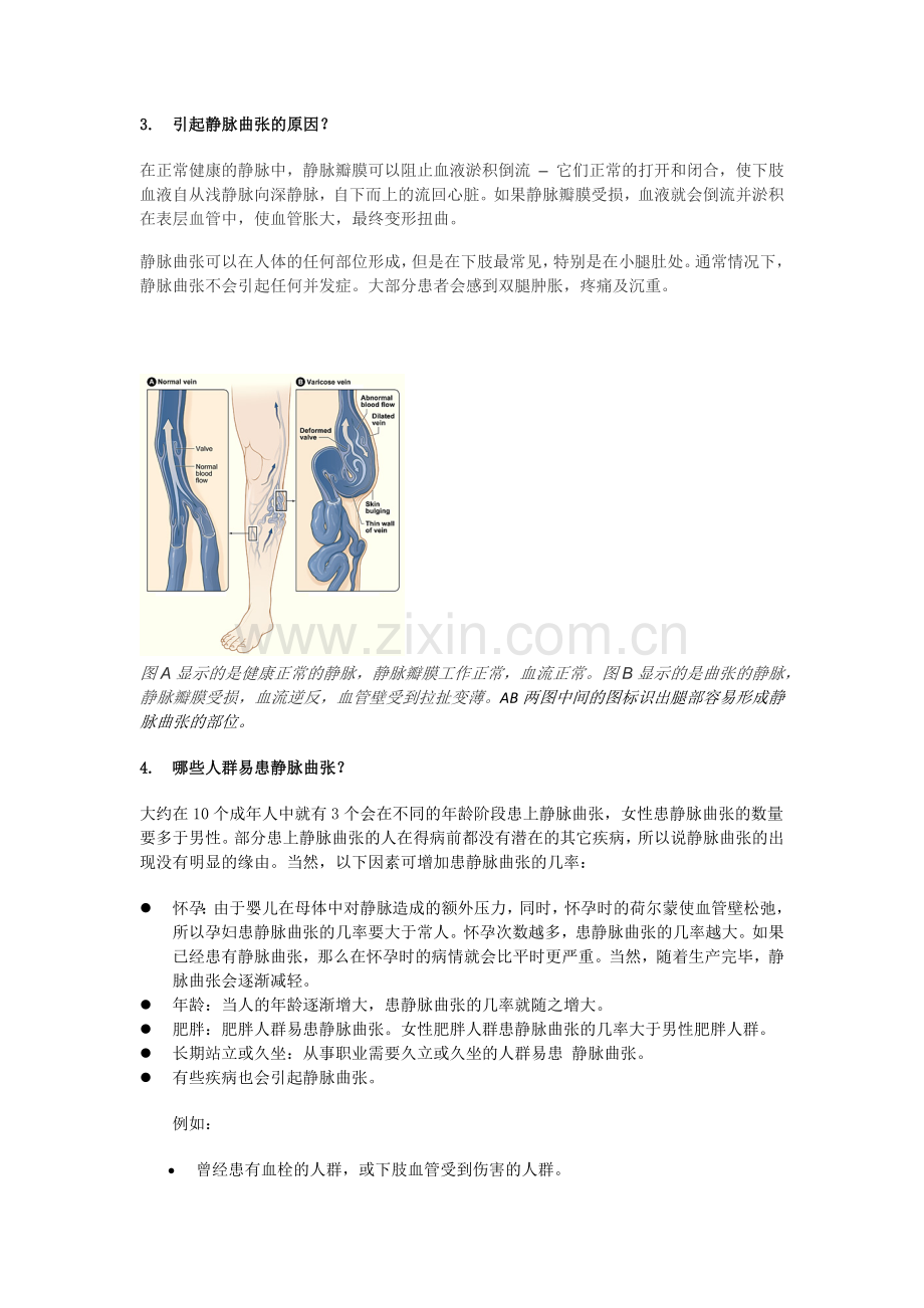 静脉曲张10大基本问题.docx_第2页