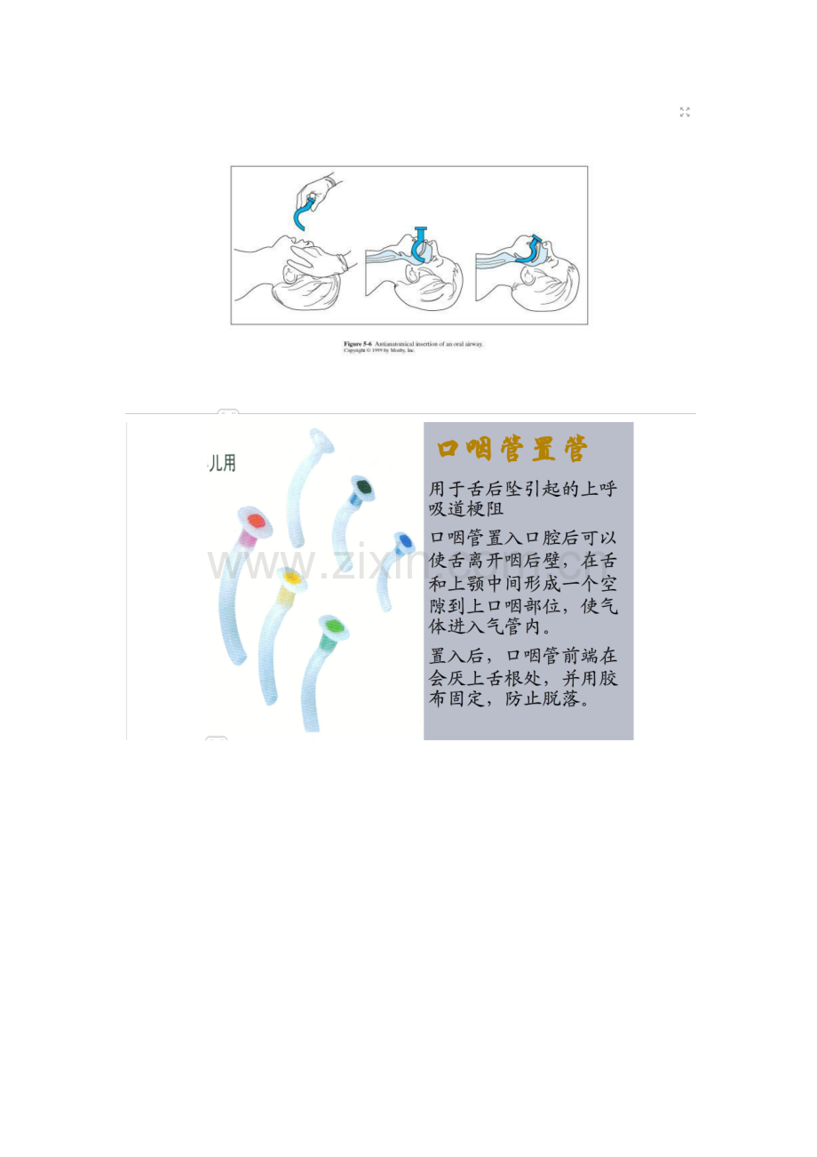 外伤和疾病的关系.docx_第2页