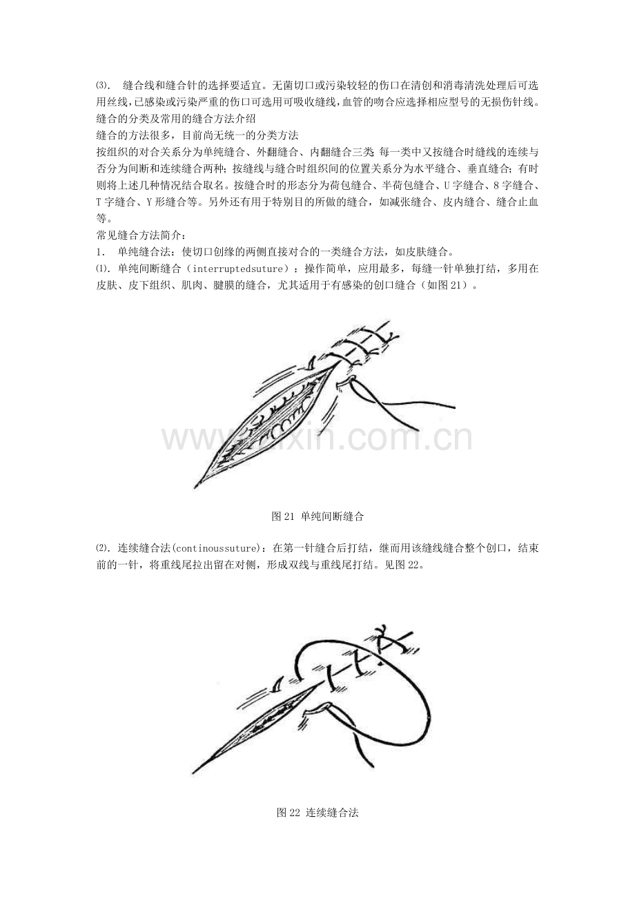 切开,各种缝合技术(2).doc_第2页