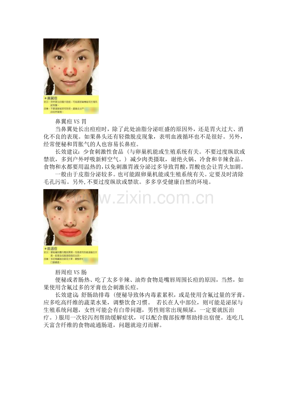 暗疮位置告诉你问题所在.doc_第2页