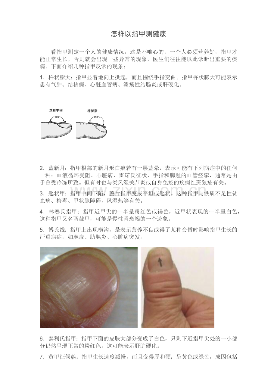 怎样以指甲测健康.docx_第1页