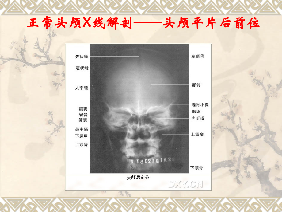 X线正常解剖(基础-精华).ppt_第1页