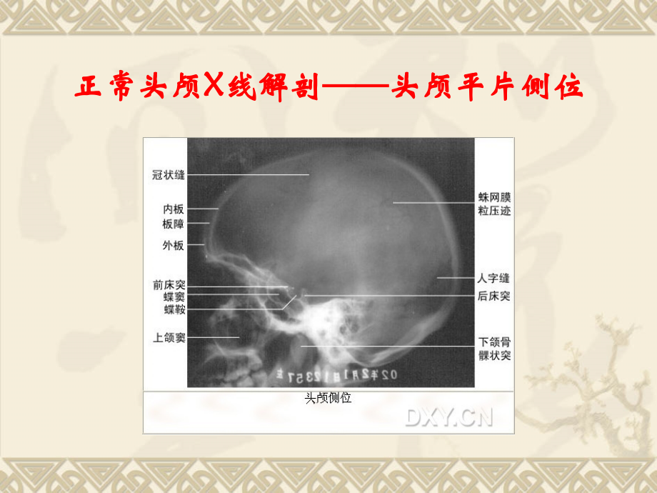 X线正常解剖(基础-精华).ppt_第2页