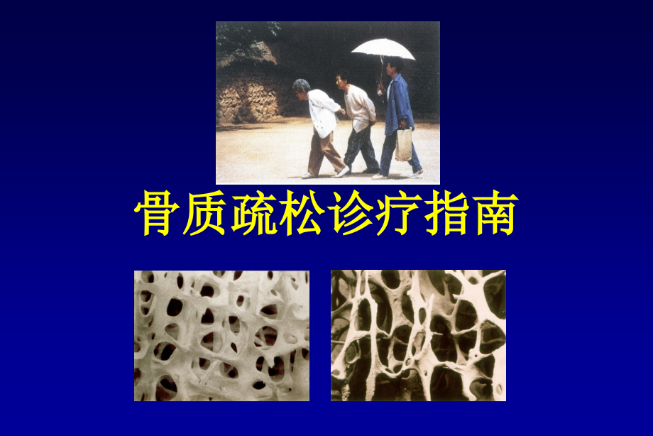 骨松指南治疗决策姚军.ppt_第1页